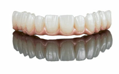 De ce se strică lucrările dentare în timp ?