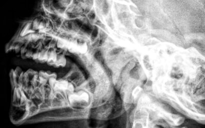 Legătura dintre sinus și dinți